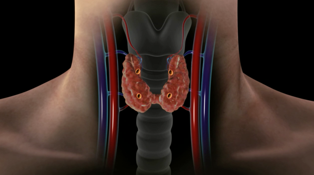 parathyroid-gland-location-dr-larian-hyperparathyroidism-surgery