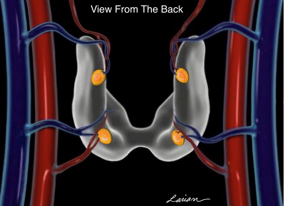 Parathyroid Anatomy Embryology Hyperparathyroidism Dr Larian 9284