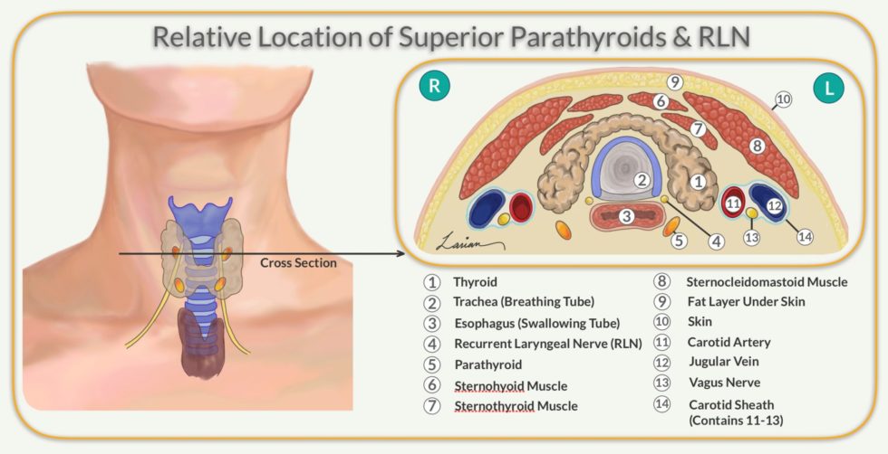Parathyroid Anatomy Embryology Hyperparathyroidism Dr Larian 8104