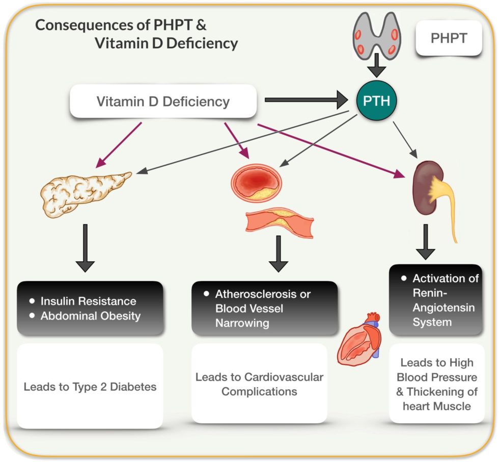 Does Low Vitamin D Increase Blood Pressure