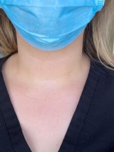 Healthcare professional wearing a surgical mask with visible neck area.